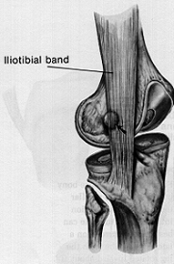 iliotibial band